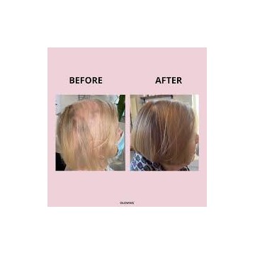Hair Food vitamins for healthy hair growth. 60 capsuls. GLOWWA