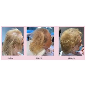 Hair Food vitamins for healthy hair growth. 60 capsuls. GLOWWA