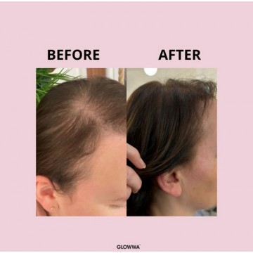 PROMOTION GLOWWA Hair Food VITAMINS 3 X 60