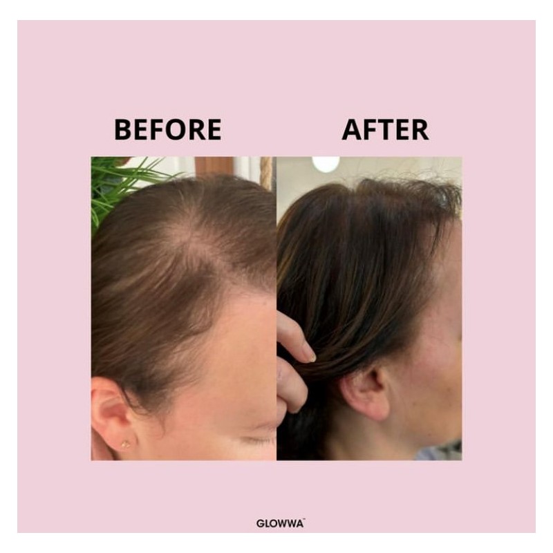 AKTION GLOWWA Hair Food 3 X 60. Fördert das Nachwachsen der Haare.