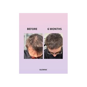 PROMOTION GLOWWA Hair Food VITAMINS 3 X 60