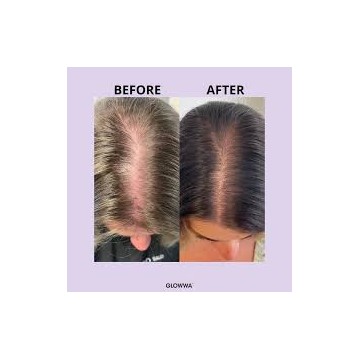 GLOWWA HAIR FOOD MENO CAPSULS 3X60